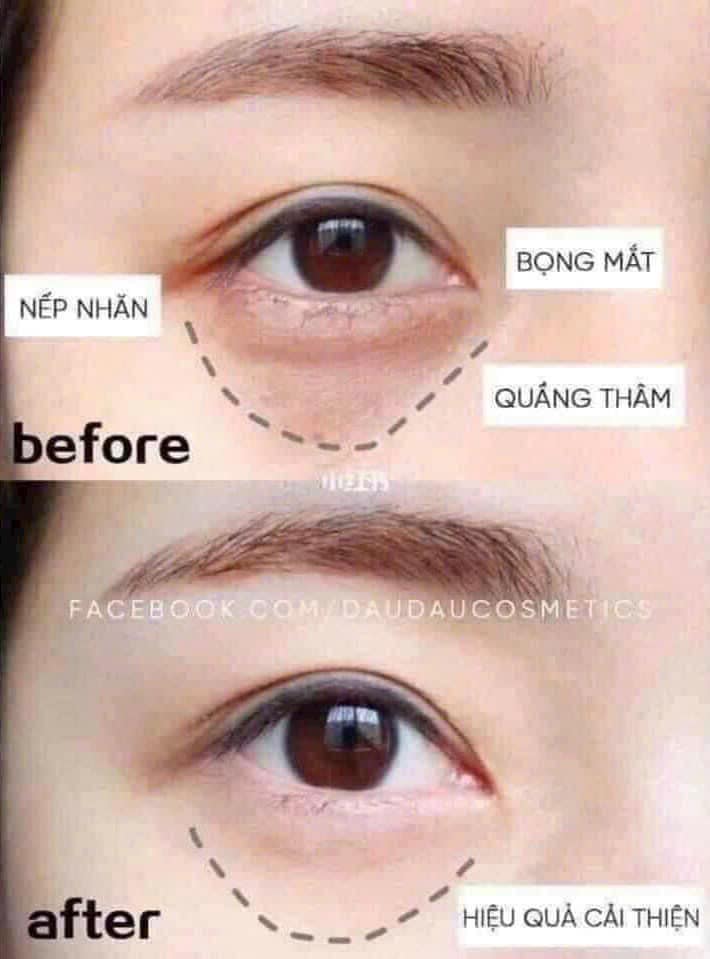 Kem dưỡng vùng mắt Ohui The First Geniture Eye Cream 4