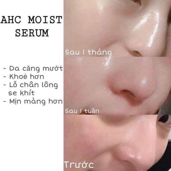 Serum AHC Capture Solution Signature 3