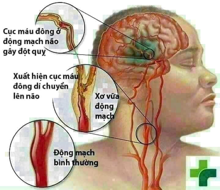 AN CUNG NGƯU HOÀNG HOÀN TỔ KÉN CAO CẤP 2