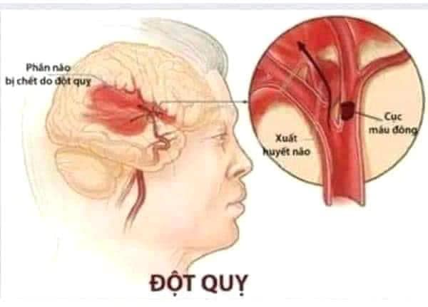 AN CUNG NGƯU HOÀNG HOÀN TỔ KÉN CAO CẤP 3