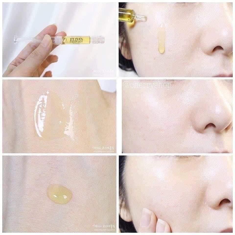 Tế bào gốc Eldas 2