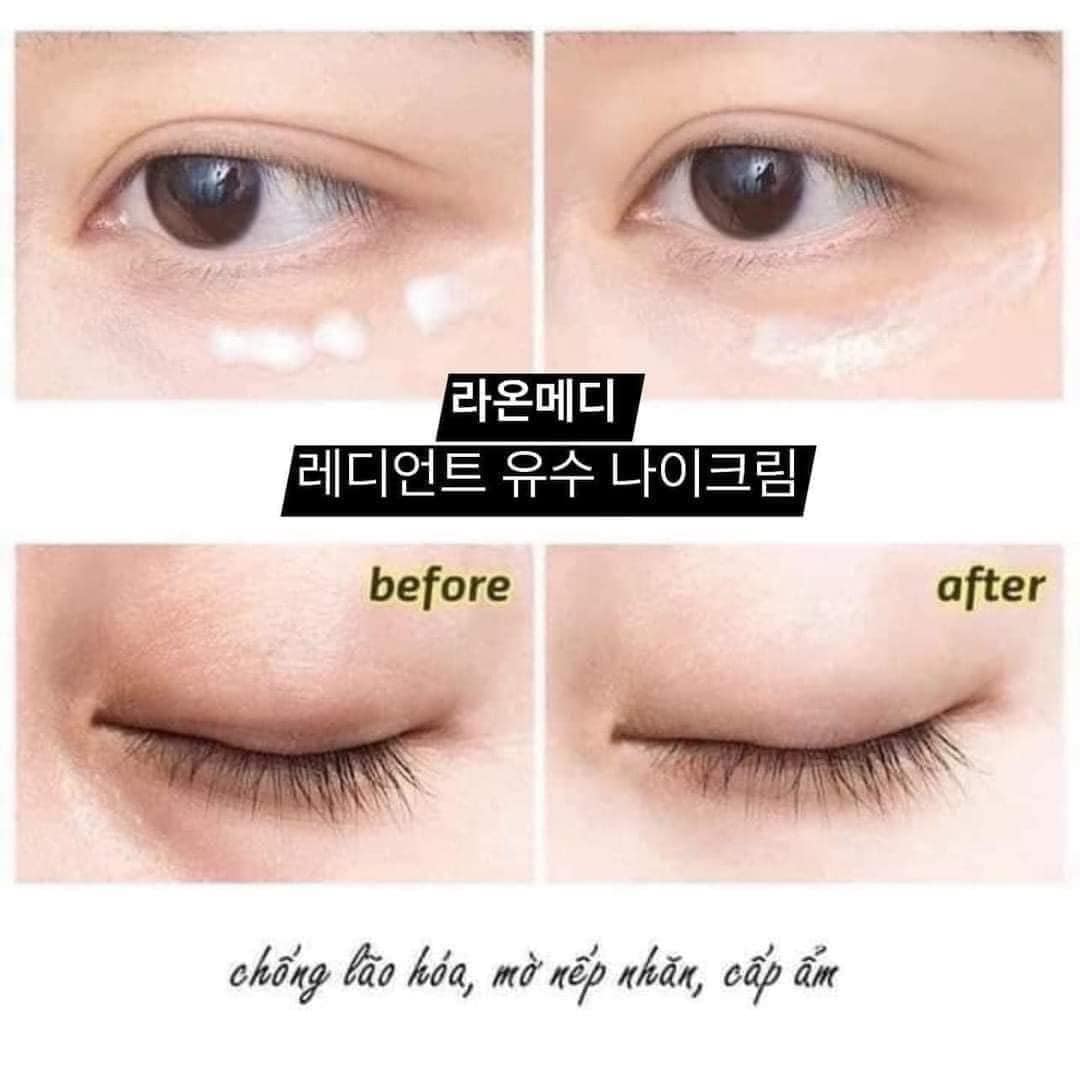  LAONMEDI RADIANT YOUTH EYE CREAM KEM DƯỠNG DA VÙNG MẮT 4