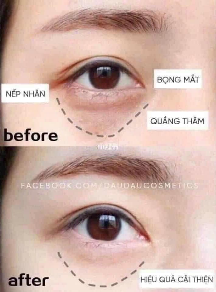 kem mắt ohui age recovery eye cream for all 4